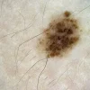 DERMAUX DX3 IMAGES