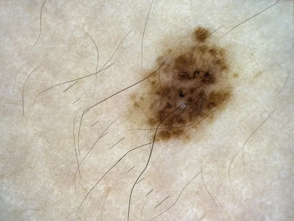 DERMAUX DX3 IMAGES